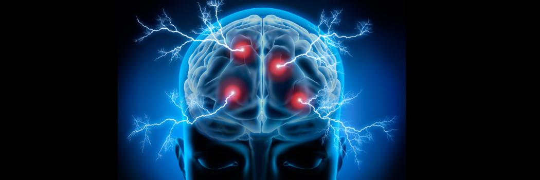 An abstract illustration of a brain with electrical activity